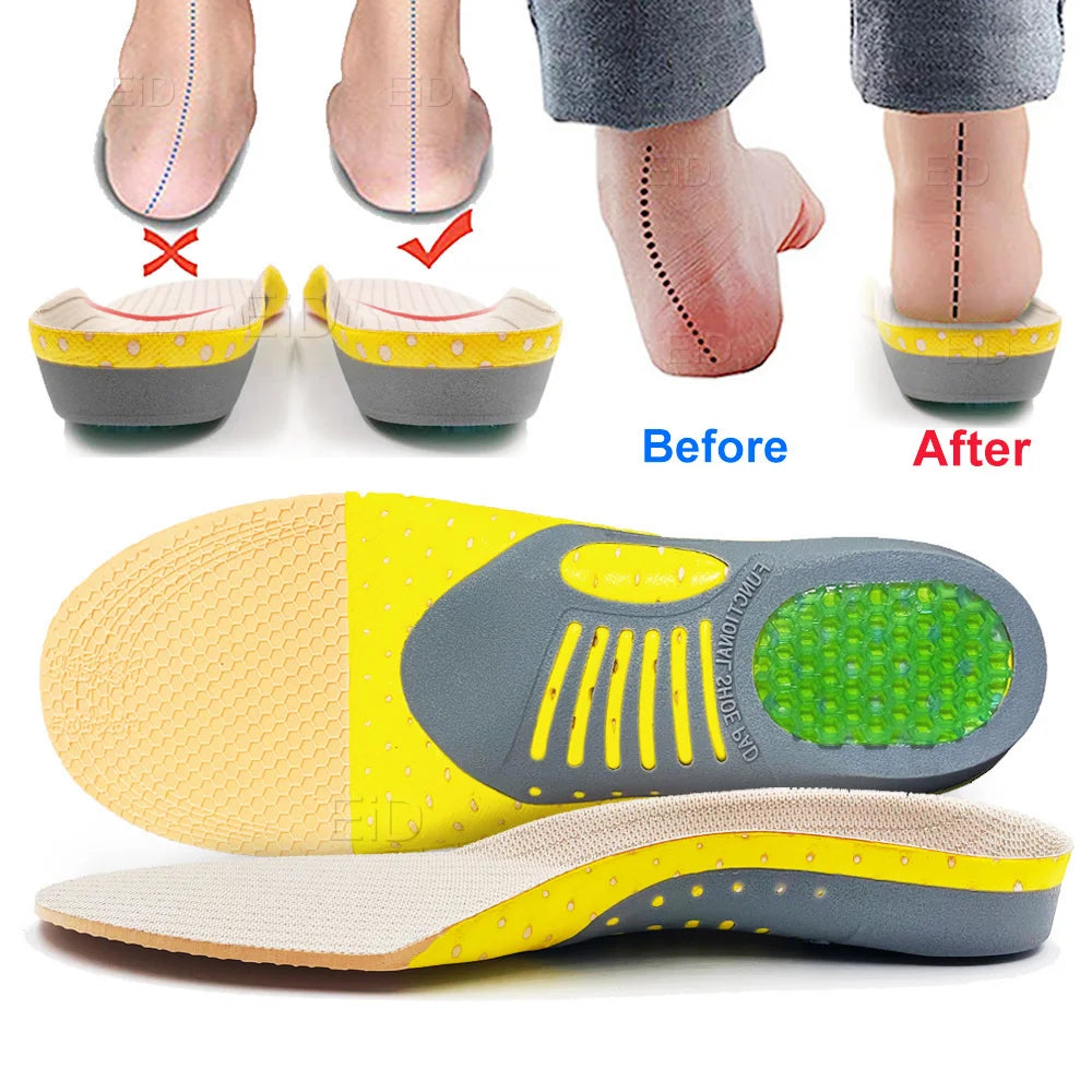 Noxwear - Premium Orthotic Gel Insoles Orthopedic Flat Foot Health Sole Pad For Shoes Insert Arch Support Pad For Plantar fasciitis Unisex