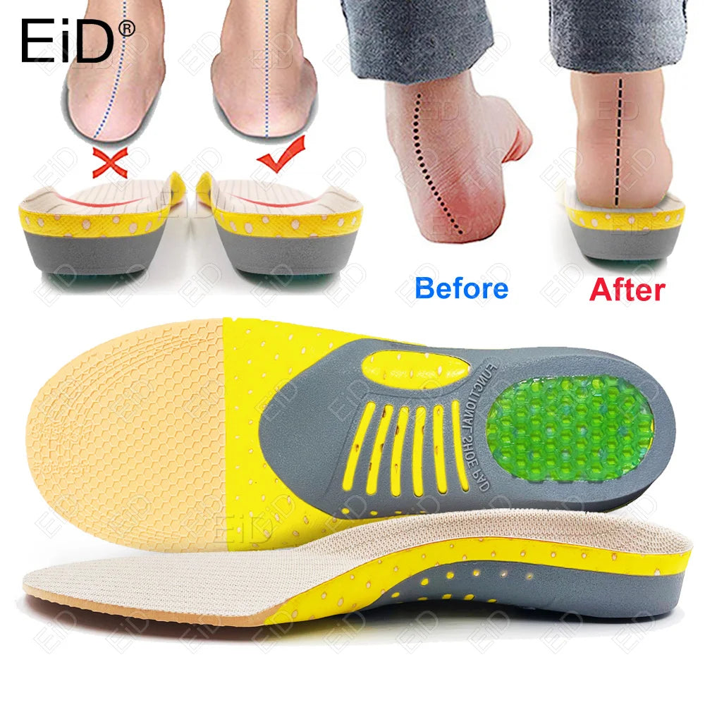 Noxwear - Premium Orthotic Gel Insoles Orthopedic Flat Foot Health Sole Pad For Shoes Insert Arch Support Pad For Plantar fasciitis Unisex