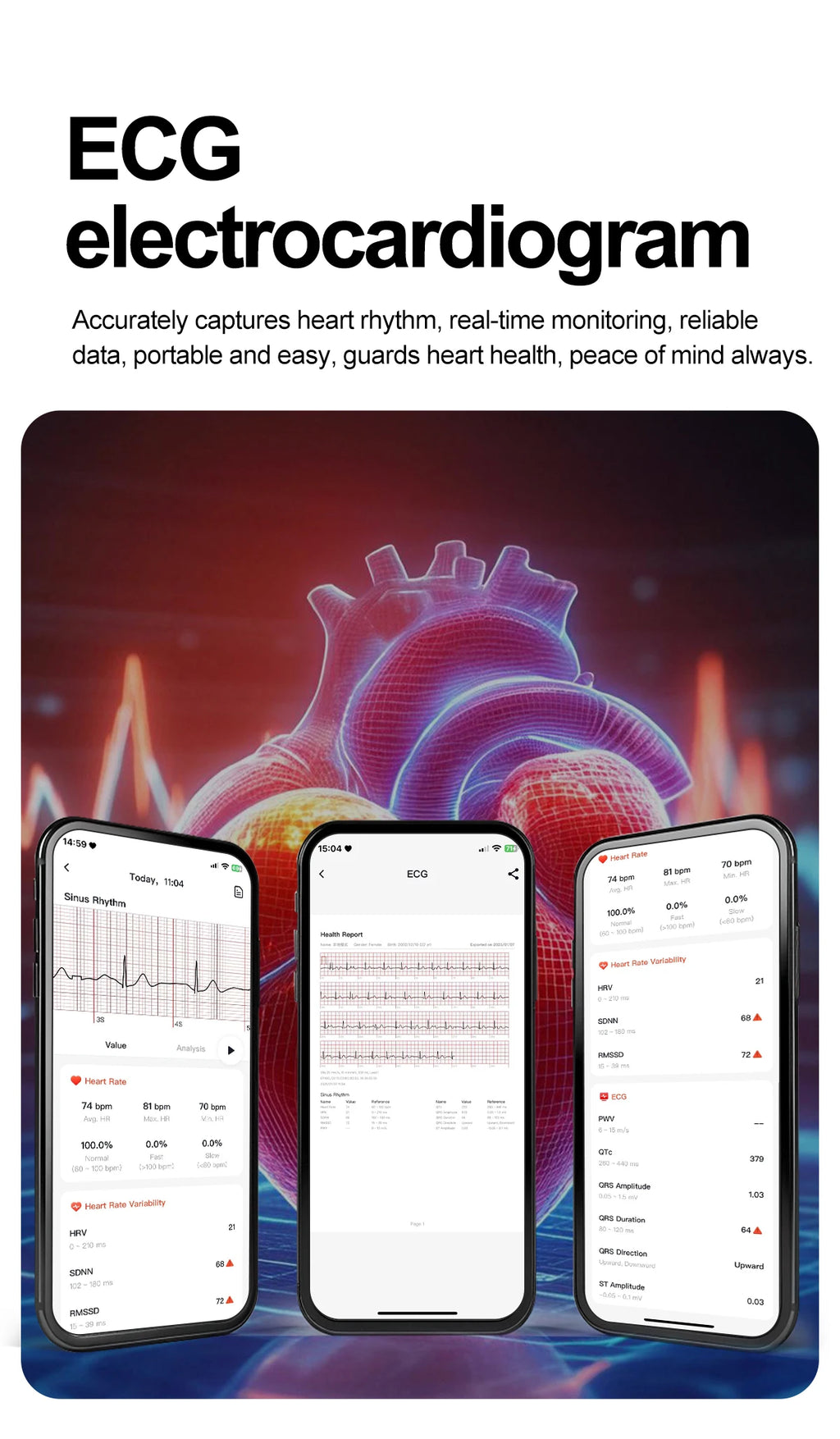 Noxwear - 2025 New Accurate ECG Smart Watch Heart Health Analysis Blood analysis Blood Lipid Blood Pressure BT call Smart Watches For Men